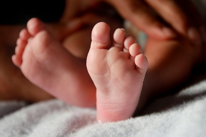 Ministry Of Health: Two Babies Born With Microcephaly