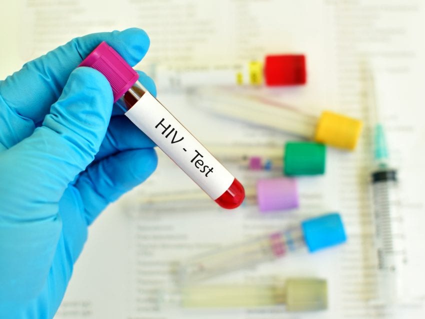 HIV Rapid Testing Only By Sanctioned Officials
