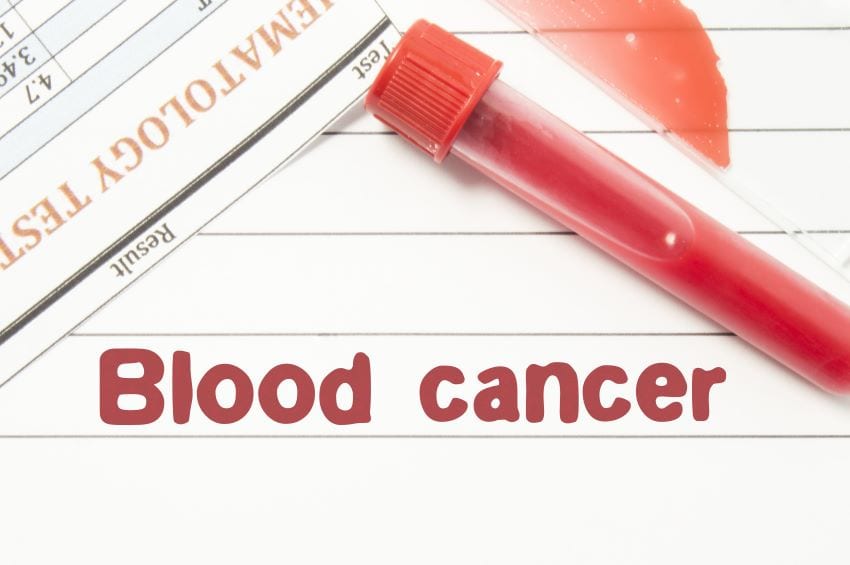 Men To Discuss Blood Cancers At Meeting