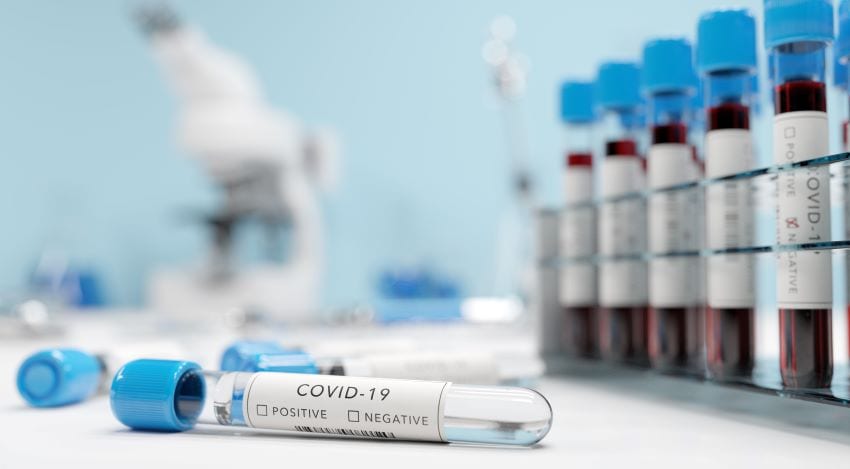 Health Ministry: Get Tested For COVID-19